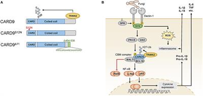 CARD9 Signaling in Intestinal Immune Homeostasis and Oncogenesis